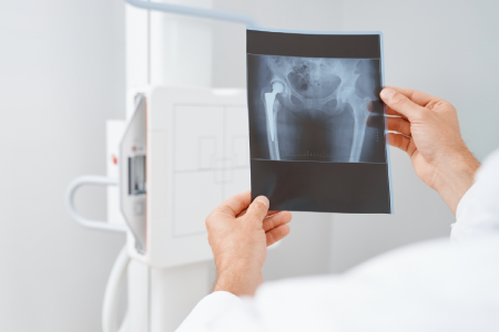 Treatments Banner Image